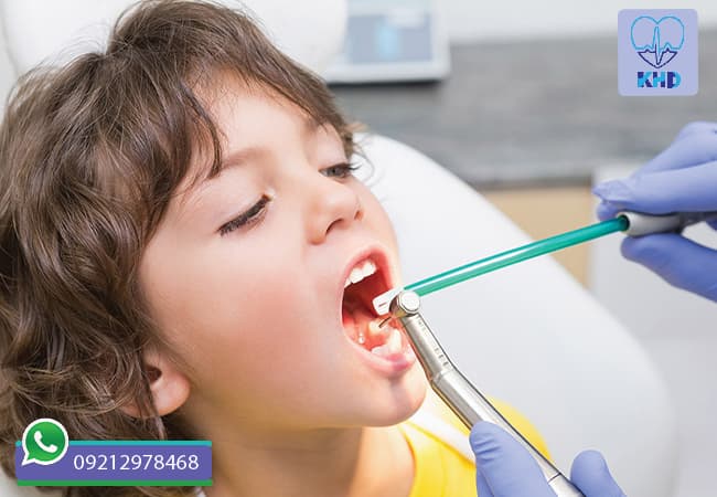 مزایا ساکشن دندانپزشکی