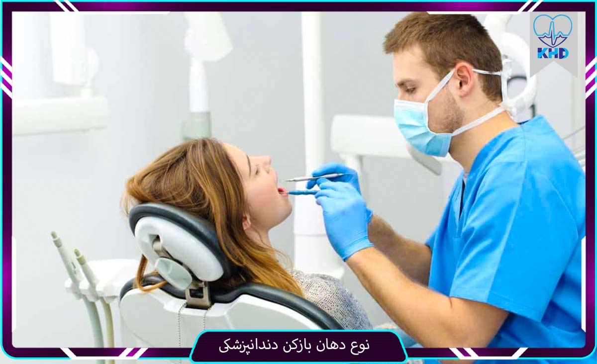 نوع دهان بازکن دندانپزشکی