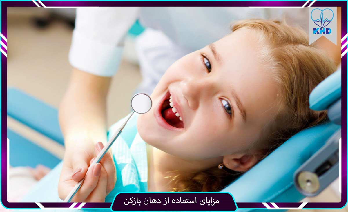مزایای دهان بازکن دندان